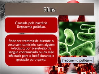SífilisSífilis
Treponema pallidumTreponema pallidum..Treponema pallidumTreponema pallidum..
 