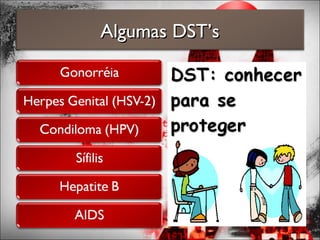 Algumas DST’sAlgumas DST’s
 