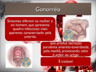 GonorréiaGonorréia
 