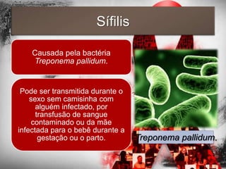 Sífilis

    Causada pela bactéria
    Treponema pallidum.


 Pode ser transmitida durante o
    sexo sem camisinha com
      alguém infectado, por
      transfusão de sangue
    contaminado ou da mãe
infectada para o bebê durante a
       gestação ou o parto.       Treponema pallidum.
 