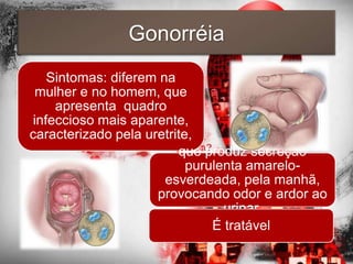 Gonorréia
   Sintomas: diferem na
 mulher e no homem, que
    apresenta quadro
infeccioso mais aparente,
caracterizado pela uretrite,
                         que produz secreção
                           purulenta amarelo-
                      esverdeada, pela manhã,
                     provocando odor e ardor ao
                                 urinar.
                               É tratável
 