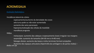 Avaliação Radiológica:
•Incidência lateral do crânio:
espessamento/aumento da densidade dos ossos
sela turca pode ou não estar aumentada
aumento dos seios paranasais
hiperpneumatização das células da mastóide
mandíbula prognata
•Mãos
metacarpos: aumento das cabeças e espessamento ósseo irregular nas margens
sesamóide: aumento do tamanho (M>30 mm e H>40 mm)
falanges distais: aumento das bases e tufos terminais formam projeções
Aumento dos espaços articulares (hipertrofia da cartilagem e de partes moles) –
dedos em pá
 