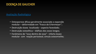Avaliação Radiológica
• Osteoporose difusa geralmente associada a expansão
medular – deformidade em “frasco de Erlenmeyer”;
• Destruição óssea localizada – aspecto faveolado;
• Destruição osteolítica – diáfises dos ossos longos;
• Fenômeno de “osso dentro de osso” : infarto ósseo
medular com reação periosteal; simula osteomielite;
 