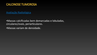 Avaliação Radiológica
•Massas calcificadas bem demarcadas e lobuladas,
circulares/ovais, periarticulares.
•Massas variam de densidade.
 