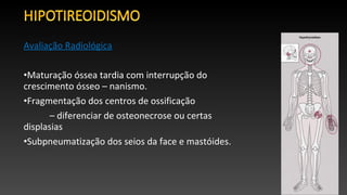 Avaliação Radiológica
•Maturação óssea tardia com interrupção do
crescimento ósseo – nanismo.
•Fragmentação dos centros de ossificação
– diferenciar de osteonecrose ou certas
displasias
•Subpneumatização dos seios da face e mastóides.
 