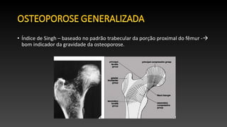 • Índice de Singh – baseado no padrão trabecular da porção proximal do fêmur -
bom indicador da gravidade da osteoporose.
 