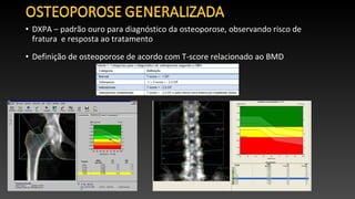 • DXPA – padrão ouro para diagnóstico da osteoporose, observando risco de
fratura e resposta ao tratamento
• Definição de osteoporose de acordo com T-score relacionado ao BMD
 