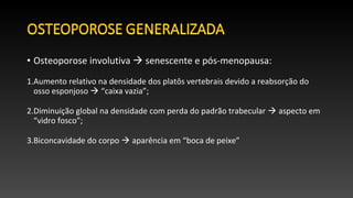 • Osteoporose involutiva  senescente e pós-menopausa:
1.Aumento relativo na densidade dos platôs vertebrais devido a reabsorção do
osso esponjoso  “caixa vazia”;
2.Diminuição global na densidade com perda do padrão trabecular  aspecto em
“vidro fosco”;
3.Biconcavidade do corpo  aparência em “boca de peixe”
 