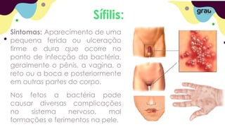 Sífilis:
Sintomas: Aparecimento de uma
pequena ferida ou ulceração
firme e dura que ocorre no
ponto de infecção da bactéria,
geralmente o pênis, a vagina, o
reto ou a boca e posteriormente
em outras partes do corpo.
Nos fetos a bactéria pode
causar diversas complicações
no sistema nervoso, mal
formações e ferimentos na pele.
 