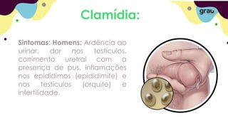 Clamídia:
Sintomas: Homens: Ardência ao
urinar, dor nos testículos,
corrimento uretral com a
presença de pus, inflamações
nos epidídimos (epididimite) e
nos testículos (orquite) e
infertilidade.
 