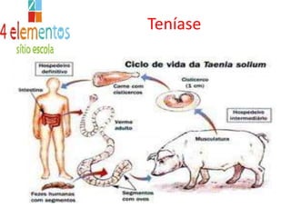 AscaridíaseSintomas: 