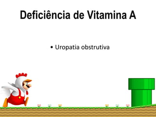 Deficiência de Vitamina A
• Uropatia obstrutiva
 
