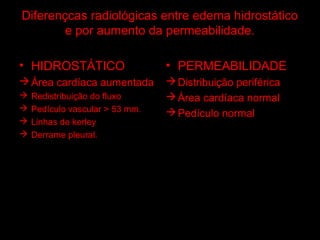 Diferençcas radiológicas entre edema hidrostático
        e por aumento da permeabilidade.

• HIDROSTÁTICO                   • PERMEABILIDADE
 Área cardíaca aumentada         Distribuição periférica
   Redistribuição do fluxo       Área cardíaca normal
   Pedículo vascular > 53 mm.    Pedículo normal
   Linhas de kerley
   Derrame pleural.
 