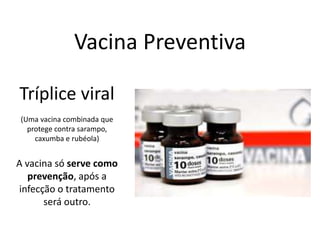 Vacina Preventiva
Tríplice viral
(Uma vacina combinada que
protege contra sarampo,
caxumba e rubéola)
A vacina só serve como
prevenção, após a
infecção o tratamento
será outro.
 