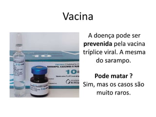 Vacina
A doença pode ser
prevenida pela vacina
tríplice viral. A mesma
do sarampo.
Pode matar ?
Sim, mas os casos são
muito raros.
 