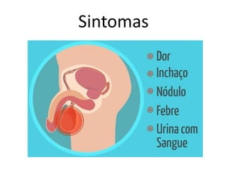Sintomas
 