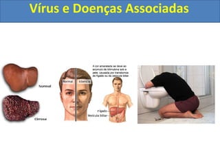 Vírus e Doenças Associadas
 