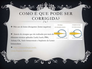 COMO É QUE PODE SER
CORRIGIDA?
 Pelo uso de lentes divergentes (lentes negativas)
 Através de cirurgias que são realizadas por meio de
diferentes técnicas aplicadas: Lasik; Lasek; PRK;
Artisan; CK, Anéis Intracorneais e Implantes de Lentes
Intraoculares
 http://www.essilor.pt/saude-
visual/Paginas/default.aspx
 