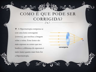 COMO É QUE PODE SER
CORRIGIDA?
 A Hipermetropia compensa-se
com uma lente convergente
(convexa), que recoloca a imagem
sobre a retina. Estas lentes são
mais espessas no centro que nos
bordos e a diferença de espessura é
tanto maior quanto mais forte for
a Hipermetropia.
 