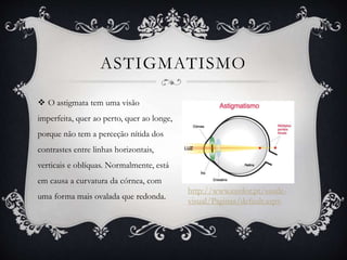 ASTIGMATISMO
 O astigmata tem uma visão
imperfeita, quer ao perto, quer ao longe,
porque não tem a perceção nítida dos
contrastes entre linhas horizontais,
verticais e oblíquas. Normalmente, está
em causa a curvatura da córnea, com
uma forma mais ovalada que redonda.
http://www.essilor.pt/saude-
visual/Paginas/default.aspx
 