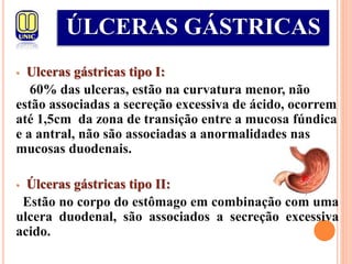 • Ulceras gástricas tipo I:
60% das ulceras, estão na curvatura menor, não
estão associadas a secreção excessiva de ácido, ocorrem
até 1,5cm da zona de transição entre a mucosa fúndica
e a antral, não são associadas a anormalidades nas
mucosas duodenais.
• Úlceras gástricas tipo II:
Estão no corpo do estômago em combinação com uma
ulcera duodenal, são associados a secreção excessiva
acido.
ÚLCERAS GÁSTRICAS
 
