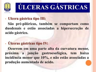 • Ulcera gástrica tipo III:
São pré-pilóricas, também se comportam como
duodenais e estão associadas a hipersecreção de
acido gástrico.
• Úlceras gástricas tipo IV:
Ocorrem em uma parte alta da curvatura menor,
próxima a junção gastroesofágica, tem baixa
incidência menor que 10%, e não estão associadas a
produção aumentada de acido.
ÚLCERAS GÁSTRICAS
 