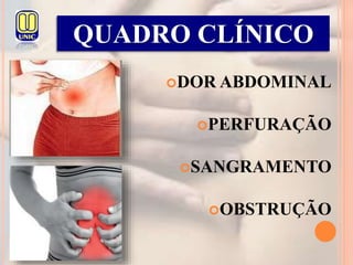 DOR ABDOMINAL
PERFURAÇÃO
SANGRAMENTO
OBSTRUÇÃO
QUADRO CLÍNICO
 