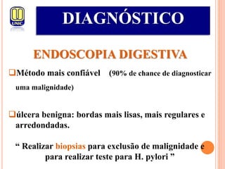 DIAGNÓSTICO
ENDOSCOPIA DIGESTIVA
Método mais confiável (90% de chance de diagnosticar
uma malignidade)
úlcera benigna: bordas mais lisas, mais regulares e
arredondadas.
“ Realizar biopsias para exclusão de malignidade e
para realizar teste para H. pylori ”
 
