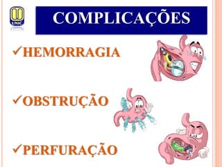 COMPLICAÇÕES
HEMORRAGIA
OBSTRUÇÃO
PERFURAÇÃO
 
