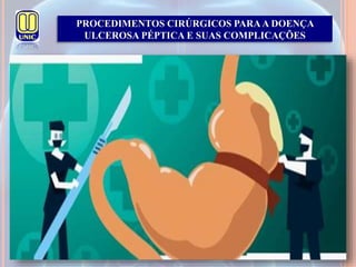 PROCEDIMENTOS CIRÚRGICOS PARAA DOENÇA
ULCEROSA PÉPTICA E SUAS COMPLICAÇÕES
 