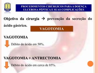 Objetivo da cirurgia  prevenção da secreção do
ácido gástrico.
PROCEDIMENTOS CIRÚRGICOS PARAA DOENÇA
ULCEROSA PÉPTICA E SUAS COMPLICAÇÕES
VAGOTOMIA
VAGOTOMIA
Débito do ácido em 50%.
VAGOTOMIA + ANTRECTOMIA
Débito do ácido em cerca de 85%.
 