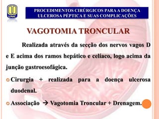 PROCEDIMENTOS CIRÚRGICOS PARAA DOENÇA
ULCEROSA PÉPTICA E SUAS COMPLICAÇÕES
VAGOTOMIA TRONCULAR
Realizada através da secção dos nervos vagos D
e E acima dos ramos hepático e celíaco, logo acima da
junção gastroesofágica.
 Cirurgia + realizada para a doença ulcerosa
duodenal.
 Associação  Vagotomia Troncular + Drenagem.
 