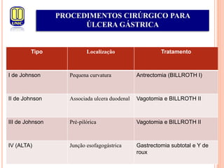 Tipo Localização Tratamento
I de Johnson Pequena curvatura Antrectomia (BILLROTH I)
II de Johnson Associada ulcera duodenal Vagotomia e BILLROTH II
III de Johnson Pré-pilórica Vagotomia e BILLROTH II
IV (ALTA) Junção esofagogástrica Gastrectomia subtotal e Y de
roux
PROCEDIMENTOS CIRÚRGICO PARA
ÚLCERA GÁSTRICA
 