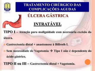 ÚLCERA GÁSTRICA
INTRATÁVEL
TIPO I – Atenção para malignidade com necessária excisão da
úlcera.
 Gastrectomia distal + anastomose à Billroth I.
 Sem necessidade de Vagotomia  Tipo I não é dependente do
ácido gástrico.
TIPO II ou III – Gastrectomia distal + Vagotomia.
TRATAMENTO CIRÚRGICO DAS
COMPLICAÇÕES AGUDAS
 