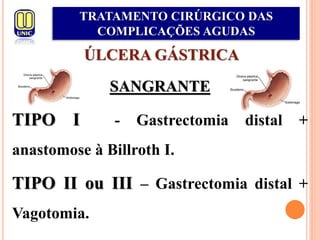 ÚLCERA GÁSTRICA
SANGRANTE
TIPO I - Gastrectomia distal +
anastomose à Billroth I.
TIPO II ou III – Gastrectomia distal +
Vagotomia.
TRATAMENTO CIRÚRGICO DAS
COMPLICAÇÕES AGUDAS
 