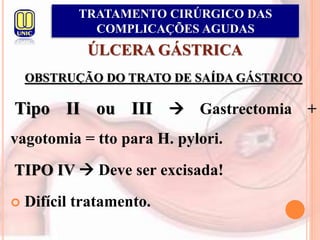 ÚLCERA GÁSTRICA
OBSTRUÇÃO DO TRATO DE SAÍDA GÁSTRICO
Tipo II ou III  Gastrectomia +
vagotomia = tto para H. pylori.
TIPO IV  Deve ser excisada!
 Difícil tratamento.
TRATAMENTO CIRÚRGICO DAS
COMPLICAÇÕES AGUDAS
 