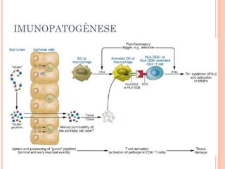 IMUNOPATOGÊNESE
 