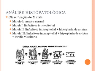 ANÁLISE HISTOPATOLÓGICA
 Classificação de Marsh
 Marsh 0: mucosa normal
 Marsh I: linfocitose intraepitelial
 Marsh II: linfocitose intraepitelial + hiperplasia de criptas
 Marsh III: linfocitose intraepitelial + hiperplasia de criptas
+ atrofia vilositária
 