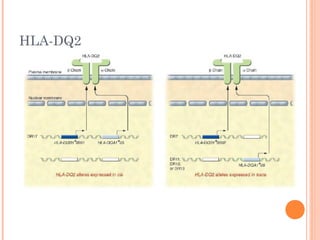 HLA-DQ2
 