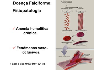 Doença Falciforme
  Fisiopatologia



   Anemia hemolítica
           crônica



   Fenômenos vaso-
       oclusivos


N Engl J Med 1999; 340:1021-30
 