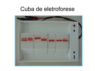 Cuba de eletroforese
 