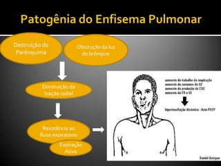 Destruição do
Parênquima
Obstrução da luz
do brônquio
Diminuição da
tração radial
Resistência ao
fluxo expiratório
Expiração
Ativa
 