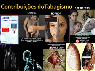 Doenca pulmonar obs_cronica_dpoc