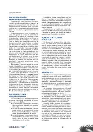 21
DOENÇA REUMATÓIDE
RUPTURA DO TENDÃO
EXTENSOR LONGO DO POLEGAR
É o tendão que rompe com maior freqüência
na mão, normalmente ao nível do tubérculo de
Lister, no terceiro compartimento dorsal. A pre-
sença de sinovite persistente neste local, rela-
ciona-se com o comprometimento deste tendão
e deve ser uma das indicações de sinovectomia
precoce.
A ruptura do extensor longo do polegar pro-
voca uma perda da função de extensão da
interfalângica do polegar. O tratamento cirúrgi-
co de escolha é a transferência tendinosa do
extensor próprio do indicador ou do extensor
curto do polegar. Em pacientes portadores de
doença reumatóide há preferência na utiliza-
ção do extensor curto do polegar, principal-
mente quando houver comprometimento asso-
ciado da articulação metacarpofalângica.
Nestes pacientes, freqüentemente, há indica-
ção de artrodese da metacarpofalângica e o
extensor curto do polegar pode ser transferido
sem prejuízo de função. Além disso, este ten-
dão está próximo do extensor longo do pole-
gar, exige menor dissecção e proporciona uma
extensão do polegar com alguma abdução
associada, o que pode proporcionar melhor
função para a mão.
A abordagem é realizada através de incisão
dorsal, individualiza-se os tendões que serão
utilizados para a transferência e o extensor lon-
go do polegar. Se houver indicação, a articula-
ção metacarpofalângica pode ser artrodesada.
O tendão a ser transferido é seccionado ao
nível da metacarpofalângica e suturado através
da técnica em "casa de botão" (diâmetros
semelhantes) ou "Pulvertaft" (diâmetros dife-
rentes), com fio inabsorvível 4 zeros. Após a
sutura da pele, o polegar deve ser imobilizado
em extensão. O paciente deve ser encaminha-
do precocemente para reabilitação, onde será
confeccionada órtese de proteção e iniciada
movimentação passiva precoce. A movimenta-
ção ativa normalmente é iniciada por volta da
4º a 6º semana de pós-operatório.
RUPTURA DO FLEXOR
LONGO DO POLEGAR
É o tendão flexor que mais freqüentemente
se rompe na doença reumatóide. A ruptura
pode ocorrer em 3 sítios:
1. por avulsão em sua inserção - reconstru-
ção normalmente realizada com enxertos
de tendão
2. ao nível da metacarpofalângica - recons-
trução através da transferência de tendão
flexor superficial (4º dedo) ou, mais rara-
mente, através de enxertos de tendão.
3. no canal do carpo - reconstrução através
da transferência de tendão flexor superfi-
cial (4º dedo) ou, mais raramente, atra-
vés de enxertos de tendão.
A incisão é ventral, medio-lateral ou tipo
Bruner, no polegar, e curvilínea ou oblíqua
ventral no punho. Os tendões flexor longo do
polegar e aqueles utilizados para transferência
ou enxerto são identificados e a sutura dos
tendões é realizada através das técnicas habi-
tuais já descritas.
O paciente deve ser mantido com o punho fle-
tido cerca de 40º a 60º, com uma proteção para
a extensão do polegar, seja através de aparelho
gessado ou, preferencialmente, órtese.
RUPTURA DOS FLEXORES
DOS DEDOS
Os dedos mais comprometidos são o indi-
cador e o médio e os sítios mais freqüentes
são na porção distal do canal do carpo e na
entrada do túnel osteofibroso. Quando a ruptu-
ra ocorre no túnel osteofibroso, a reconstrução
é realizada com enxerto tendinoso, em geral
do palmar longo ou plantar delgado. Se houver
ruptura do profundo com integridade do super-
ficial, o procedimento de escolha deverá ser a
manutenção do superficial intacto e a estabili-
zação da interfalângica distal através de teno-
dese ou artrodese. Nas rupturas proximais é
possível utilizar o tendão flexor superficial
como enxerto para reconstruir o flexor profun-
do, tomando-se o cuidado para utilizar seg-
mentos de tendão não comprometidos pela
patologia.
ARTRODESES
Quando houver comprometimento grave da
superfície articular, com lesão irreversível do
tecido cartilaginoso, grave comprometimento
da função, quadro degenerativo progressivo
associado à sintomas dolorosos, a artrodese
da articulação deve ser considerada como um
bom procedimento terapêutico na doença reu-
matóide.
As artrodeses são principalmente indicadas
nas articulações interfalângicas do polegar,
interfalângicas proximais dos dedos, metacar-
pofalângica do polegar e no punho.
Temos dado preferência para procedimentos
de artroplastia, com ou sem prótese, para as
articulações metacarpofalângicas dos dedos,
com o objetivo de preservar mobilidade e pro-
porcionar função para a mão comprometida.
Existem várias técnicas de artrodeses.
Temos preferido realizar o desbridamento arti-
cular e retirada da cartilagem articular rema-
nescente com auxílio de serras, osteótomos
ou saca-bocados e a osteossíntese com fios
de Kirschner, associados ou não à amarrias
com fios de aço. O paciente é mantido com a
articulação imobilizada, com aparelhos gessa-
dos ou órteses, até a consolidação da artrode-
se, determinada através de exames clínico e
radiográfico.
 
