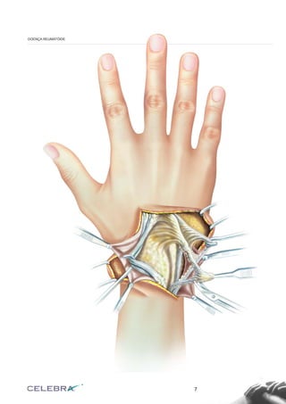 7
DOENÇA REUMATÓIDE
 