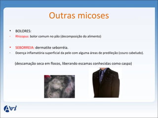 Outras micoses 
• BOLORES: 
- Rhizopus: bolor comum no pão (decomposição do alimento) 
• SEBORREIA: dermatite seborréia. 
- Doença inflamatória superficial da pele com alguma áreas de predileção (couro cabeludo). 
(descamação seca em flocos, liberando escamas conhecidas como caspa) 
