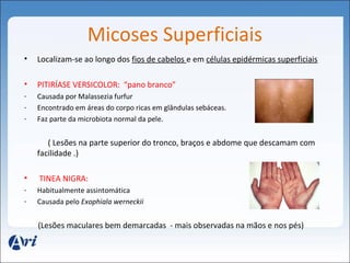 Micoses Superficiais 
• Localizam-se ao longo dos fios de cabelos e em células epidérmicas superficiais 
• PITIRÍASE VERSICOLOR: “pano branco” 
- Causada por Malassezia furfur 
- Encontrado em áreas do corpo ricas em glândulas sebáceas. 
- Faz parte da microbiota normal da pele. 
( Lesões na parte superior do tronco, braços e abdome que descamam com 
facilidade .) 
• TINEA NIGRA: 
- Habitualmente assintomática 
- Causada pelo Exophiala werneckii 
(Lesões maculares bem demarcadas - mais observadas na mãos e nos pés) 
 