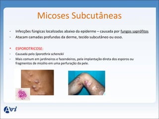 Micoses Subcutâneas 
- Infecções fúngicas localizadas abaixo da epiderme – causada por fungos saprófitos 
- Atacam camadas profundas da derme, tecido subcutâneo ou osso. 
• ESPOROTRICOSE: 
- Causada pelo Sporothrix schenckii 
- Mais comum em jardineiros e fazendeiros, pela implantação direta dos esporos ou 
fragmentos de micélio em uma perfuração da pele. 
 
