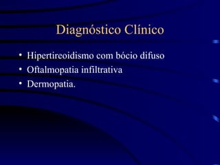 Diagnóstico Clínico Hipertireoidismo com bócio difuso Oftalmopatia infiltrativa Dermopatia. 