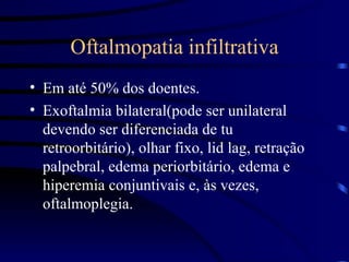 Oftalmopatia infiltrativa Em até 50% dos doentes. Exoftalmia bilateral(pode ser unilateral devendo ser diferenciada de tu retroorbitário), olhar fixo, lid lag, retração palpebral, edema periorbitário, edema e hiperemia conjuntivais e, às vezes, oftalmoplegia. 